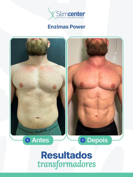 Antes e depois de Enzimas Alta Performance
