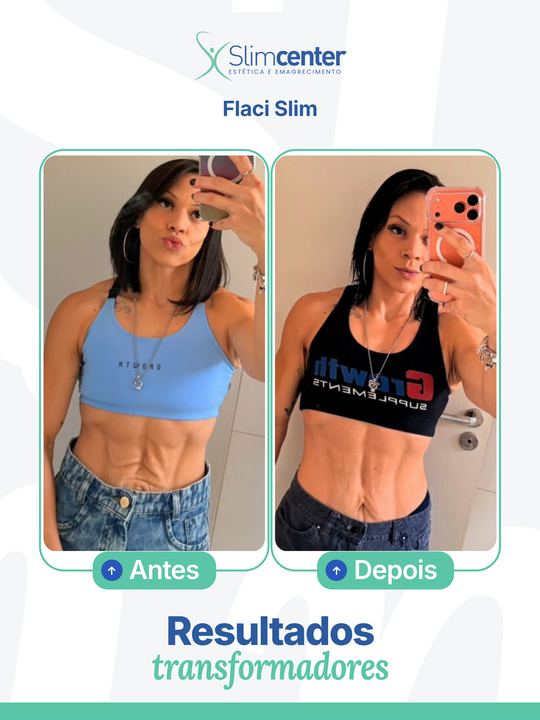 Antes e depois de Flaci Slim