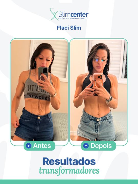 Antes e depois de Flaci Slim