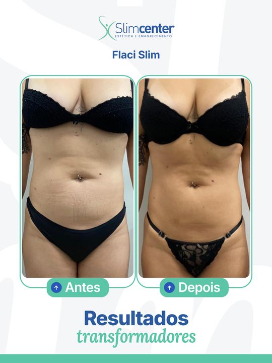 Antes e depois de Flaci Slim