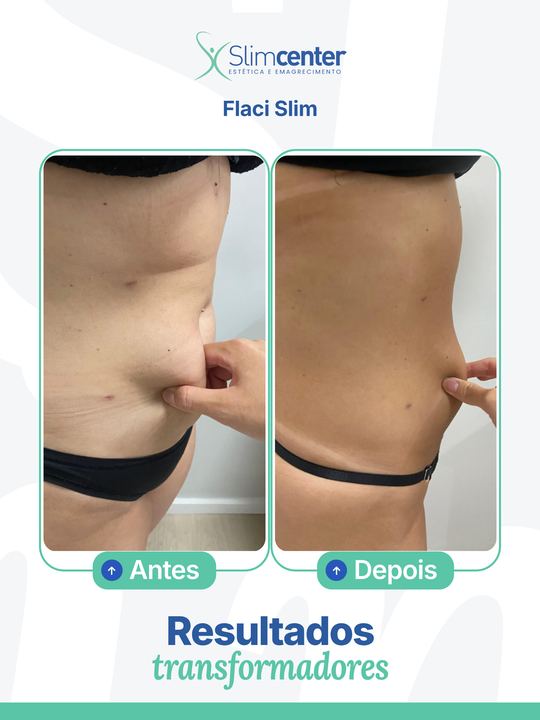 Antes e depois de Flaci Slim