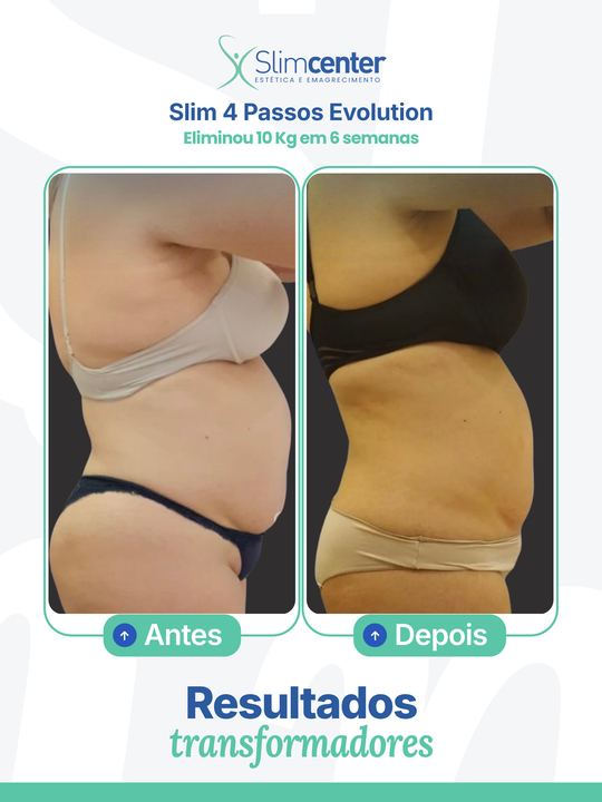 Antes e depois de Slim 4 Passos Evolution