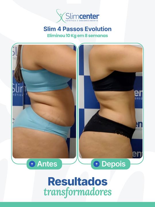 Antes e depois de Slim 4 Passos Evolution