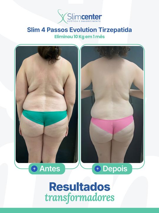 Antes e depois de Slim 4 Passos Evolution